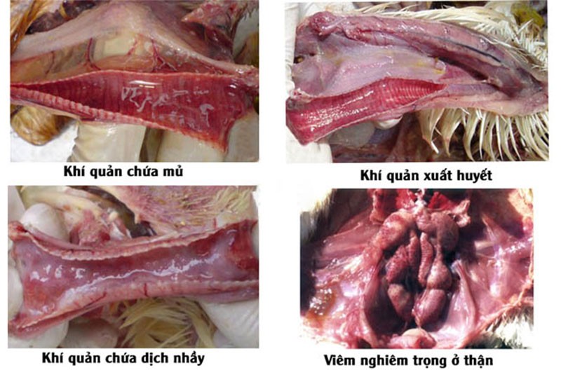 Viêm phế quản truyền nhiễm là một bệnh thường gặp khi đổi mùa